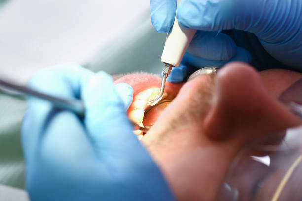 Best Emergency Dental Care for Trauma or Injury in Oakland, MD