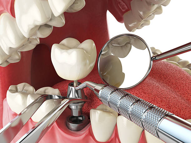 Best Emergency Treatment for Toothache in Oakland, MD